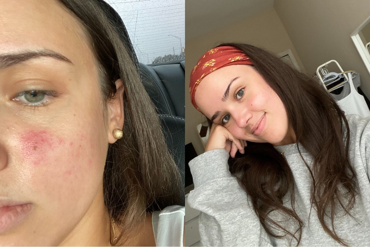 vitamin c article hero