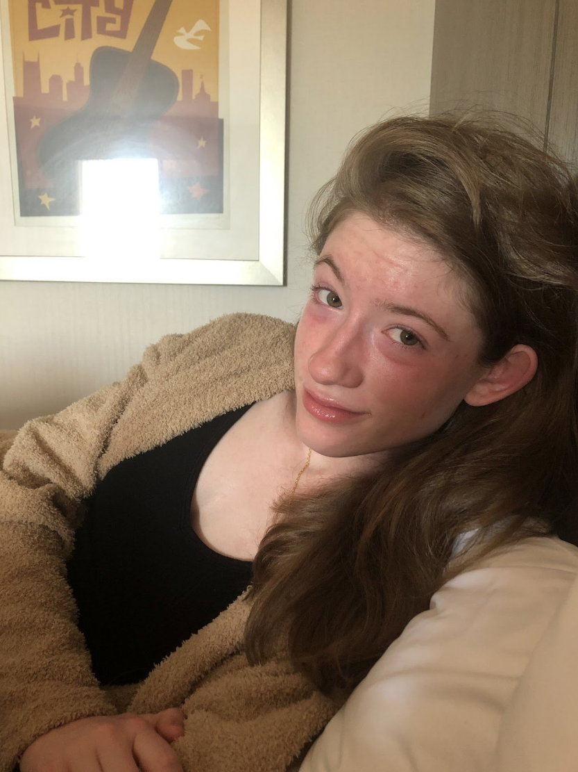 Me after crying with swollen eyes