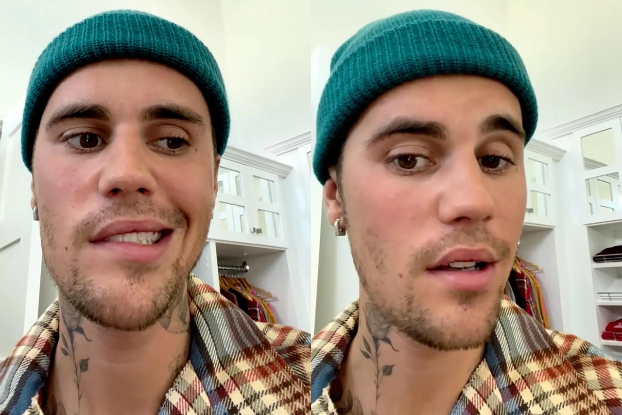 justin bieber ramsay hunt syndrome?width=698&height=466&fit=crop&auto=webp&dpr=4