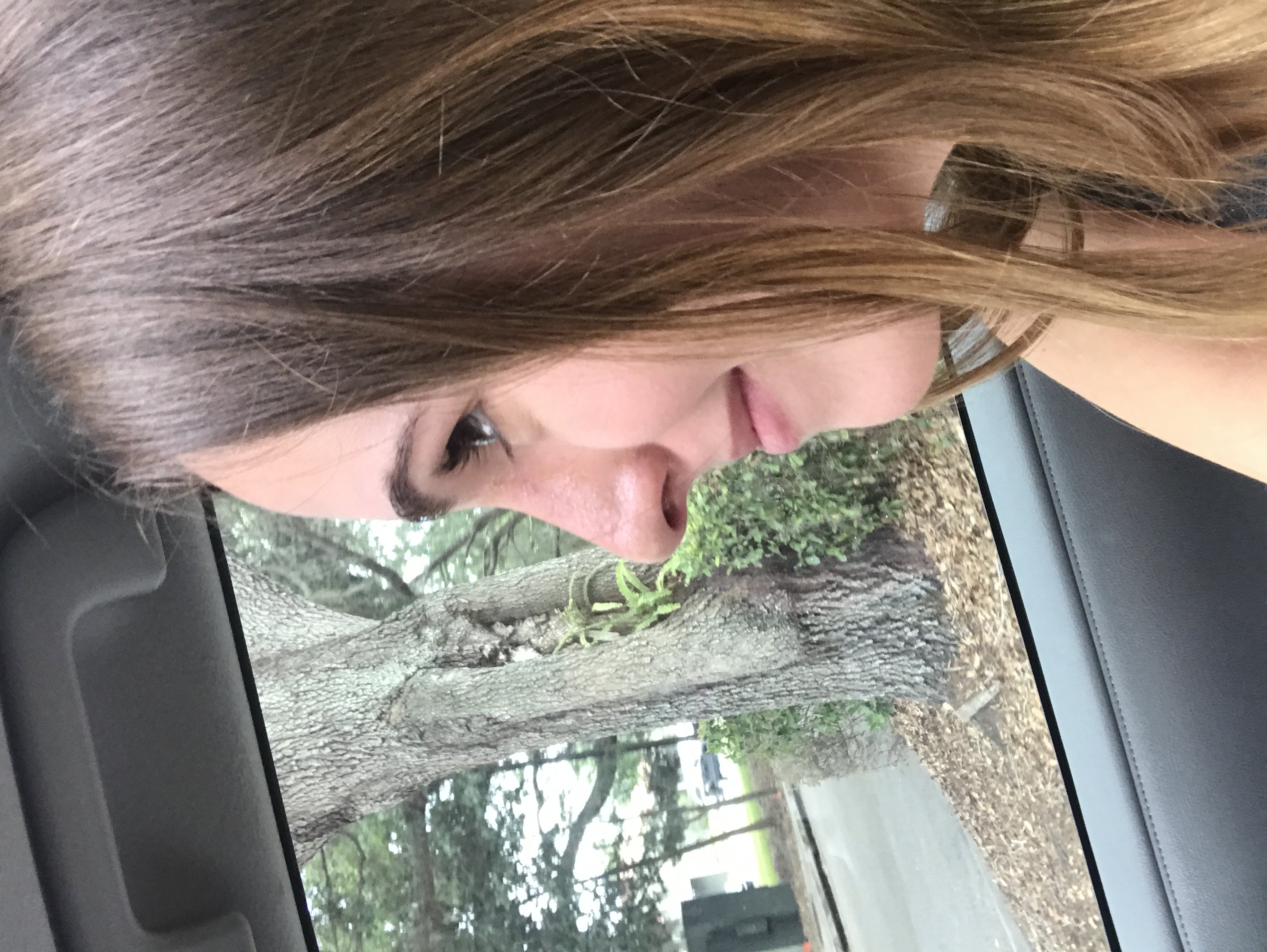 Image of my nose after surgery