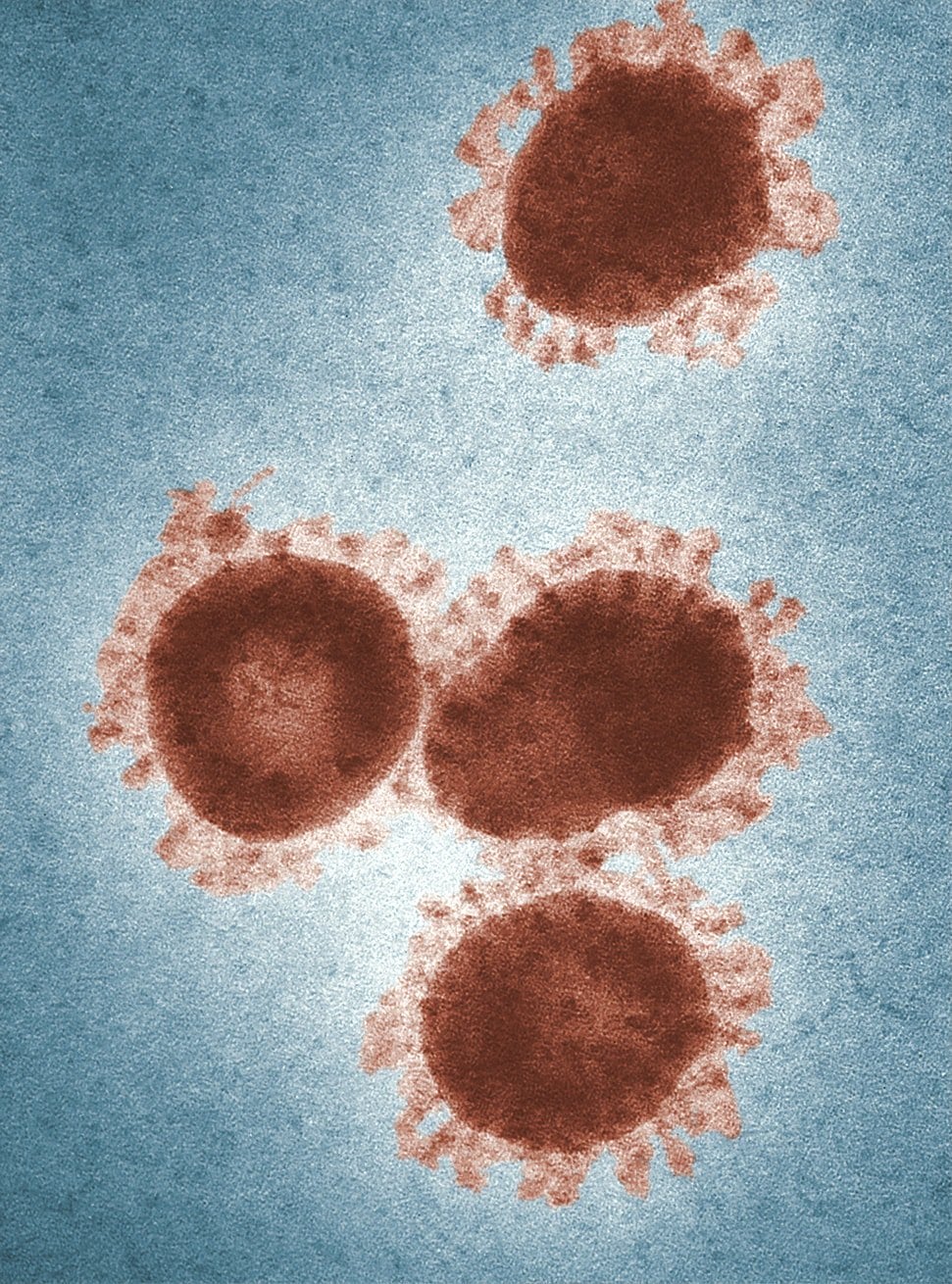 Coronavirus teal and orange