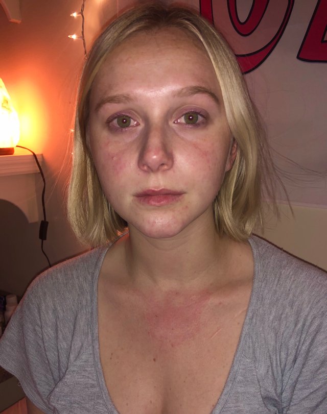 Liv Brown during an attack