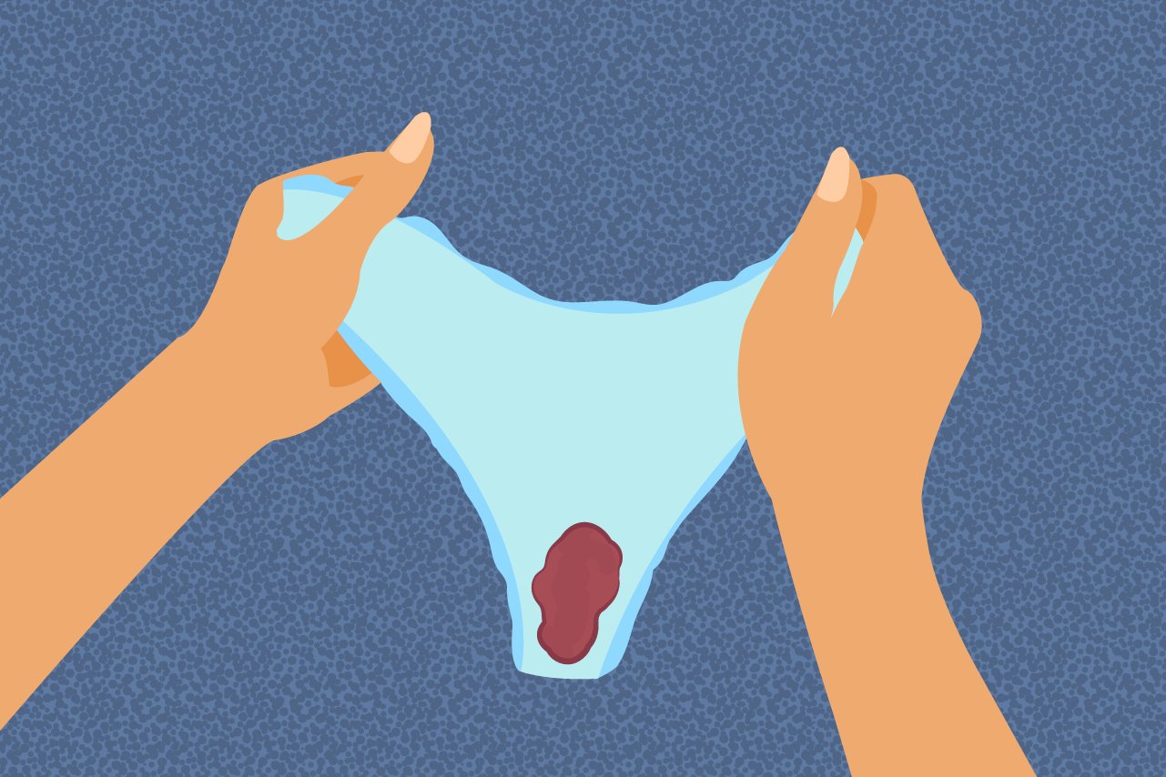 Spotting Graphic R2png?width=1280&height=854&fit=crop&auto=webp&dpr=4