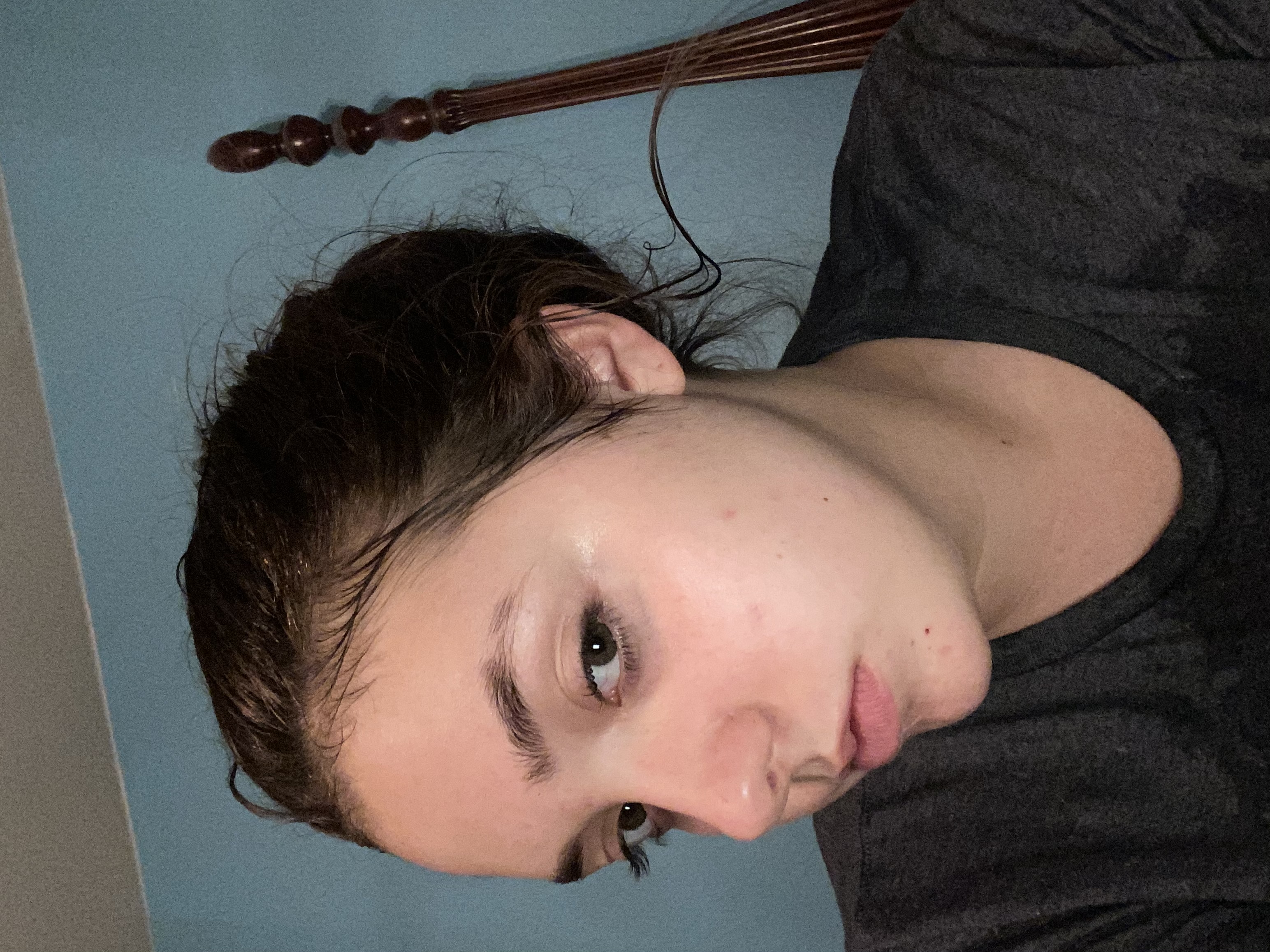 after/progress photo of my skin after routine