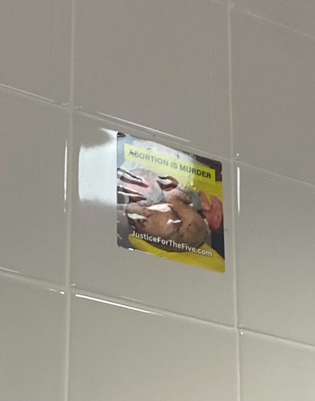 A picture of a presumably dead fetus with the caption \