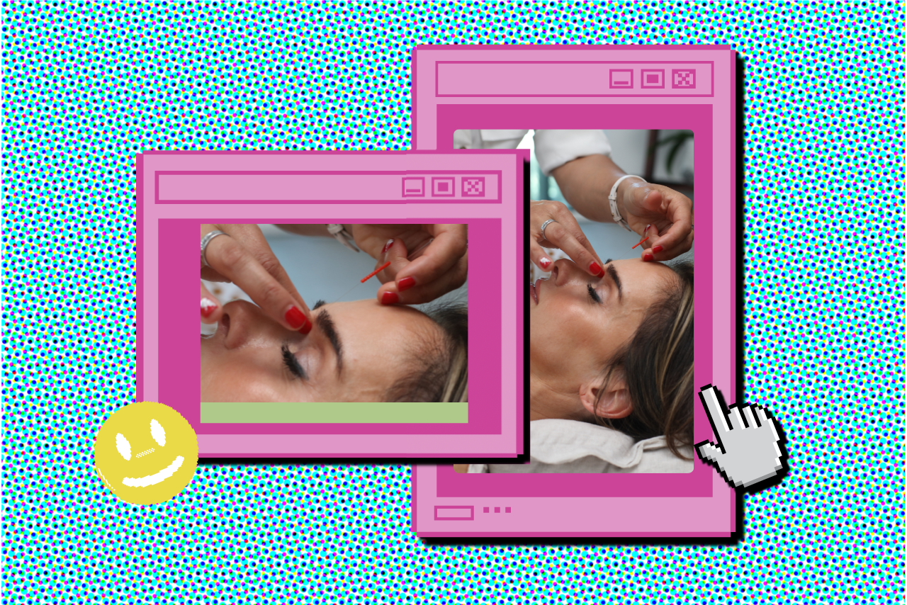 my first time acupuncture?width=1280&height=854&fit=crop&auto=webp&dpr=4